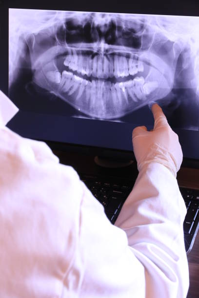 Best Emergency Root Canal Treatment in Percy, IL