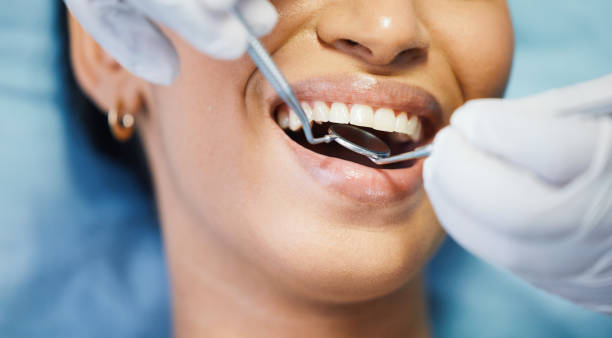 Best Emergency Root Canal Treatment in Percy, IL