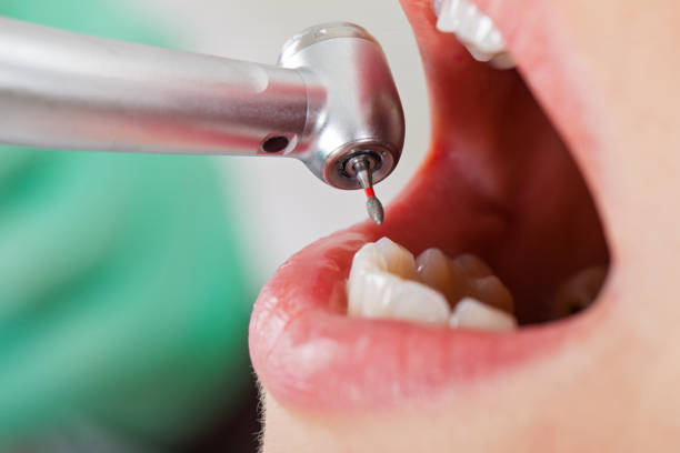 Best After-Hours Emergency Dentist in Percy, IL